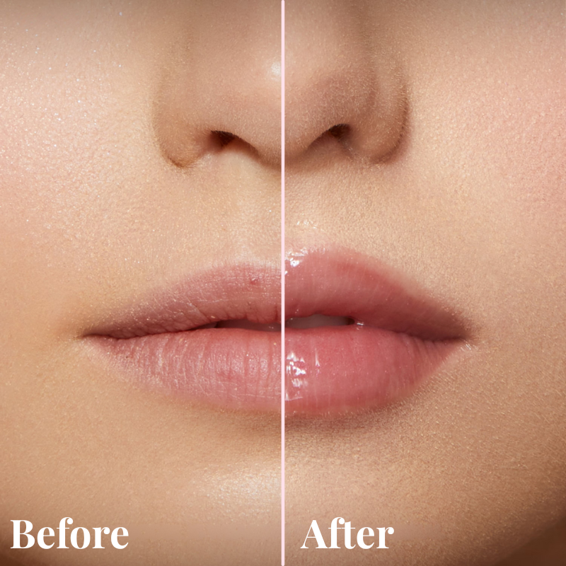 Belkare Natural Lip Plumper