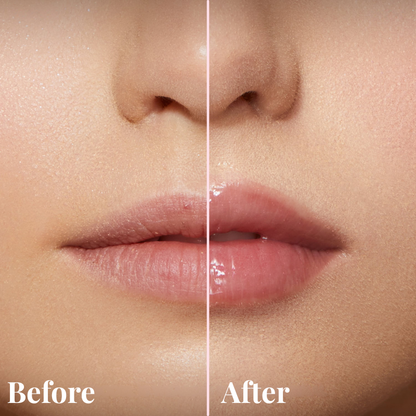Belkare Natural Lip Plumper