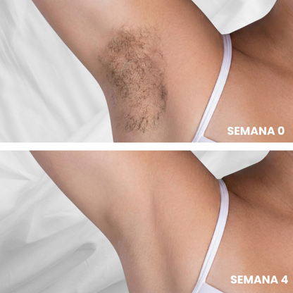 Belkare™ Aceite de Cyperus Rotundus