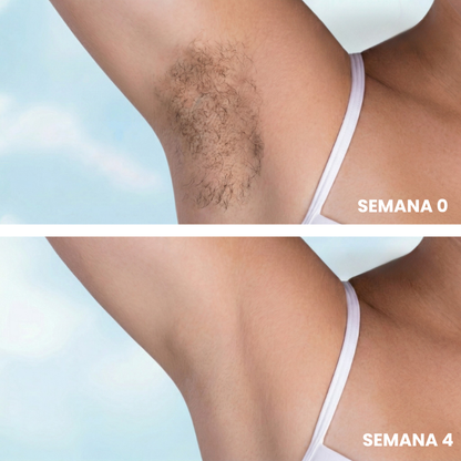 Belkare™ Aceite de Cyperus Rotundus