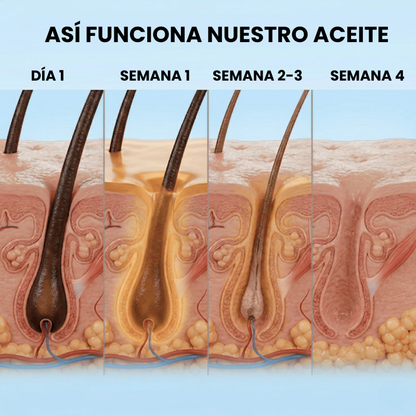 Belkare™ Aceite de Cyperus Rotundus