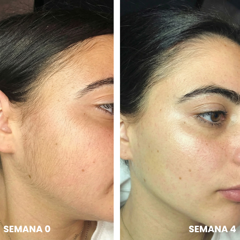 Belkare™ Aceite de Cyperus Rotundus